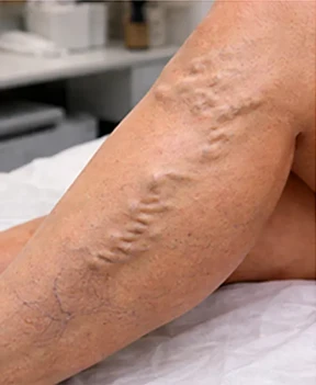 Condición inicial antes del tratamiento