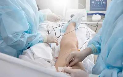 Radiofrecuencia Endovenosa